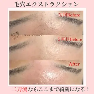 ピーリング専門店 Belluteのエステ・リラクイメージ