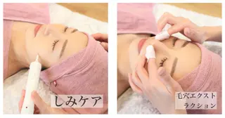 【しみ毛穴専門店】beautysalon Ankh所属・しみ毛穴専門店 Ankh 平田のエステ・リラクイメージ