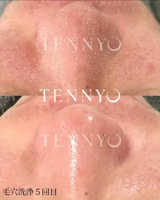 【クリニック提携】salon de moffyサロンドモフィ所属・【クリニック提携】 サロンドモフィ吉岡のエステ・リラクイメージ