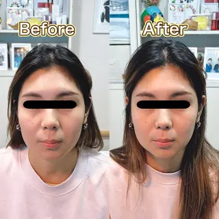 代々木美容鍼灸サロン"さくら"所属・🌸代々木美容鍼灸 サロン"さくら"🌸のエステ・リラクイメージ