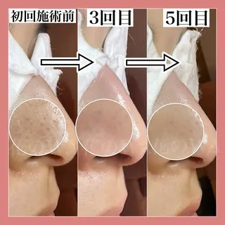 毛穴&リンパマッサージ専門サロン　花のWA所属・毛穴&リンパマッサー ジ専門サロン花のWAのエステ・リラクイメージ