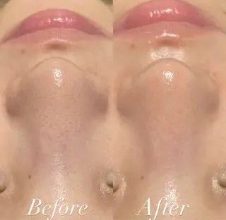 プライベートサロン Belle（ベル）のエステ・リラクイメージ