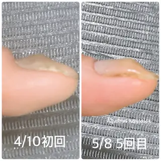 ネイル 奥園 良恵のネイルデザイン