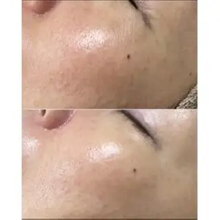 トラブル肌専門店 プレイス天王寺店のエステ・リラクイメージ