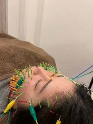 美容鍼灸Solana所属・肌質改善×美容鍼 ゆいのエステ・リラクイメージ