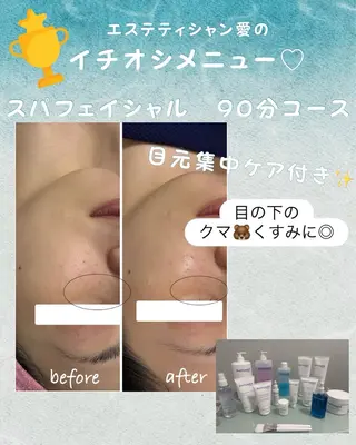 ekuRan by Rucia所属・ekuRan/ エステティシャン　愛のエステ・リラクイメージ