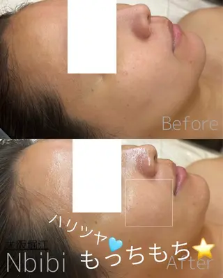 韓国🇰🇷価格 サロン_Nbibiのエステ・リラクイメージ