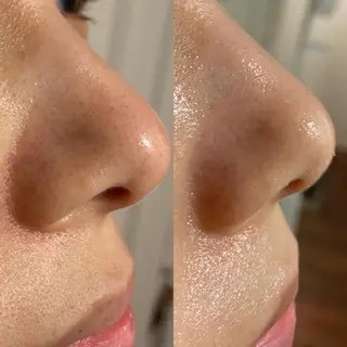 よもぎ蒸し専門店Artemisia所属・よもぎ蒸し専門店 Artemisiaのエステ・リラクイメージ