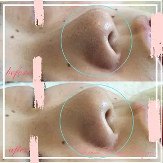 BLOOM〜 天恵（てんのめぐみ）のエステ・リラクイメージ