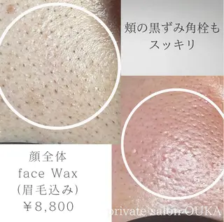アイブロウ private salon OUKA所属・OUKA脱毛 毛穴ケアフェイシャルのエステ・リラクイメージ