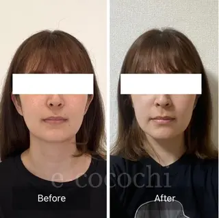 小顔と ヘッドスパのお店のエステ・リラクイメージ