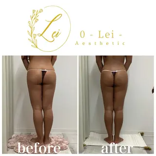 0-Lei-aesthetic所属・レイエステティック スタッフのエステ・リラクイメージ