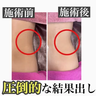 Beauty SalonEclatのエステ・リラクイメージ