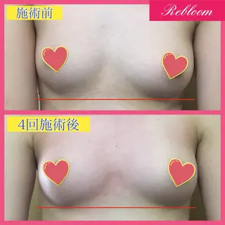 デリケートな悩み解決 Rebloomのエステ・リラクイメージ