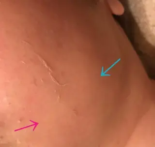 Morisugi Natsumiのエステ・リラクイメージ