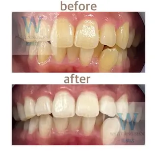 ホワイトニング ショップ船橋２号店のエステ・リラクイメージ