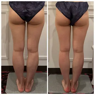 通うほど変わる本格 エステ心斎橋REVIのエステ・リラクイメージ