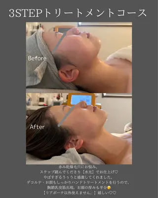 BLOSSOM 菊地のエステ・リラクイメージ