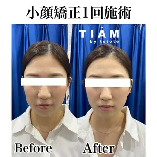 美肌サロンTIAM by tetoteのエステ・リラクイメージ