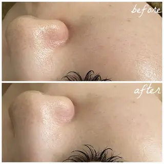 メンズ メナード岐阜茜部 杉浦のエステ・リラクイメージ