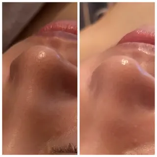 Private salon nA所属・若菜菜奈 本気の肌質改善 上島のエステ・リラクイメージ