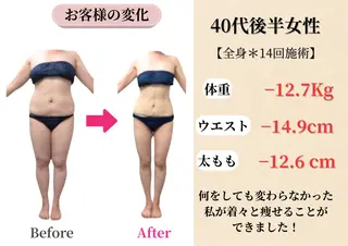 Belle White所属・本格痩身＊肌質改善＊ BelleWhiteのエステ・リラクイメージ