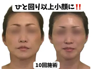 サロンハート浦和店所属・痩身小顔サロンハート 浦和店のエステ・リラクイメージ