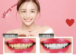 セルフホワイトニング エクシア新小岩店のその他イメージ