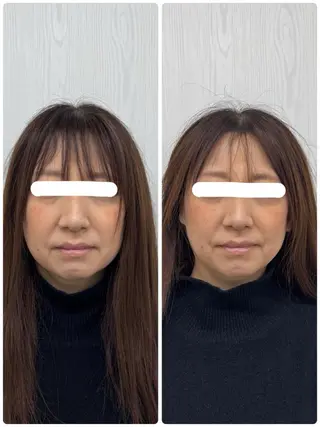 美容鍼×小顔矯正 ×美容整体　浜川泰仁のエステ・リラクイメージ