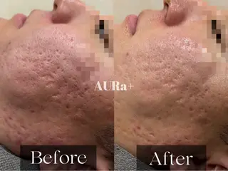 韓国風eyelush 眉毛サロン/Suuの眉毛・アイブロウイメージ