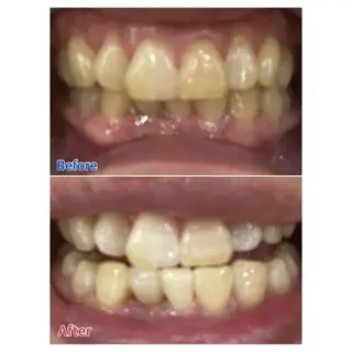 M渋谷店所属・M渋谷 ホワイトニングのエステ・リラクイメージ