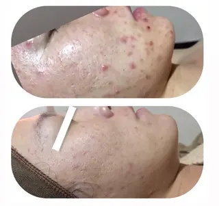 【足圧】鬼👹リンパ 身体整うサロンのエステ・リラクイメージ