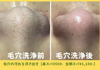 毛穴フェイシャル エステ専門店BBのエステ・リラクイメージ