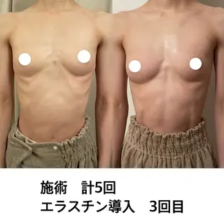 ポテンツァ&針美容 バストアップ専門店のエステ・リラクイメージ