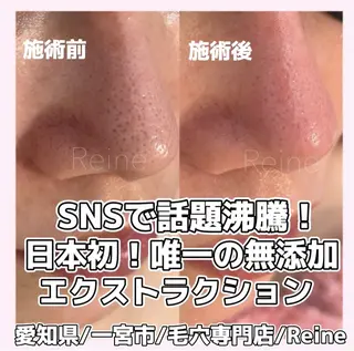 Reine BeautySalon所属・毛穴/シミ肝斑/脱毛 横山梨里のエステ・リラクイメージ