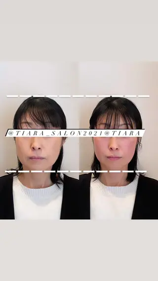 ロング カラー パーマ ヘアアレンジ メンズ キッズ ネイル マツエク・マツパ アイブロウ 美容鍼灸サロン　TIARA所属・鍼灸サロン TIARA　美容鍼のエステ・リラクイメージ