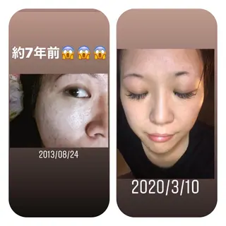 【足圧】鬼👹リンパ 身体整うサロンのエステ・リラクイメージ