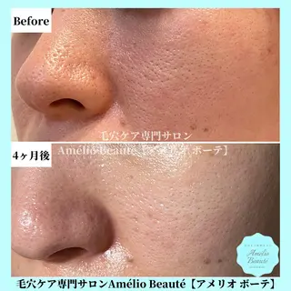 毛穴ケア専門サロン Amélio Beauté所属・毛穴ケア専門サロン アメリオボーテのその他イメージ