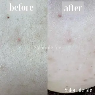 Salon de Me所属・💫Salon de Me💫予約停止中のエステ・リラクイメージ