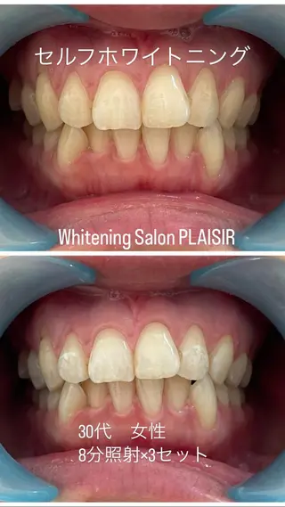 メンズ キッズ ホワイトニングサロン プレジールのエステ・リラクイメージ