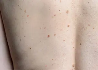 ハーブピーリング専門 muro.のエステ・リラクイメージ