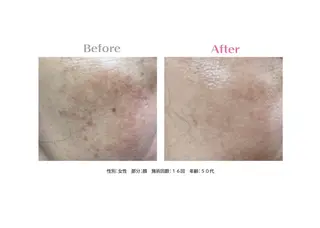 サルバトーレ所属・美容脱毛サロン なんば/namiのエステ・リラクイメージ