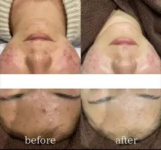 DahliaBeauty ダリアビューティー所属・Dahlia痩身脱毛 フェイシャル 中村のエステ・リラクイメージ