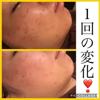 ミディアム カラー パーマ ヘアアレンジ メンズ キッズ ネイル マツエク・マツパ ニキビ・肌質改善専門 ♡人生が変わるサロンのエステ・リラクイメージ