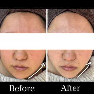 Belle beauty salon所属・Bellebeau tysalonのエステ・リラクイメージ