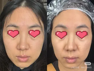 マツエク・マツパ aliaハイフ&水光ジェットサロン所属・aliaハーブ水光店 エステティシャン募集のエステ・リラクイメージ