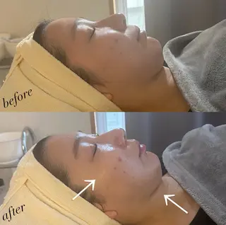 うなじ脱毛/美肌脱毛 LABELのエステ・リラクイメージ