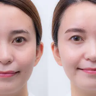 アイブロウ MDラボ 下西の眉毛・アイブロウイメージ