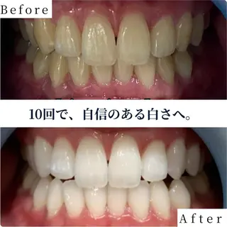 ホワイトニング ショップ南堀江のその他イメージ