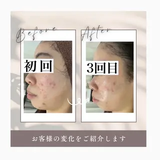 Horishia 福岡博多店のエステ・リラクイメージ